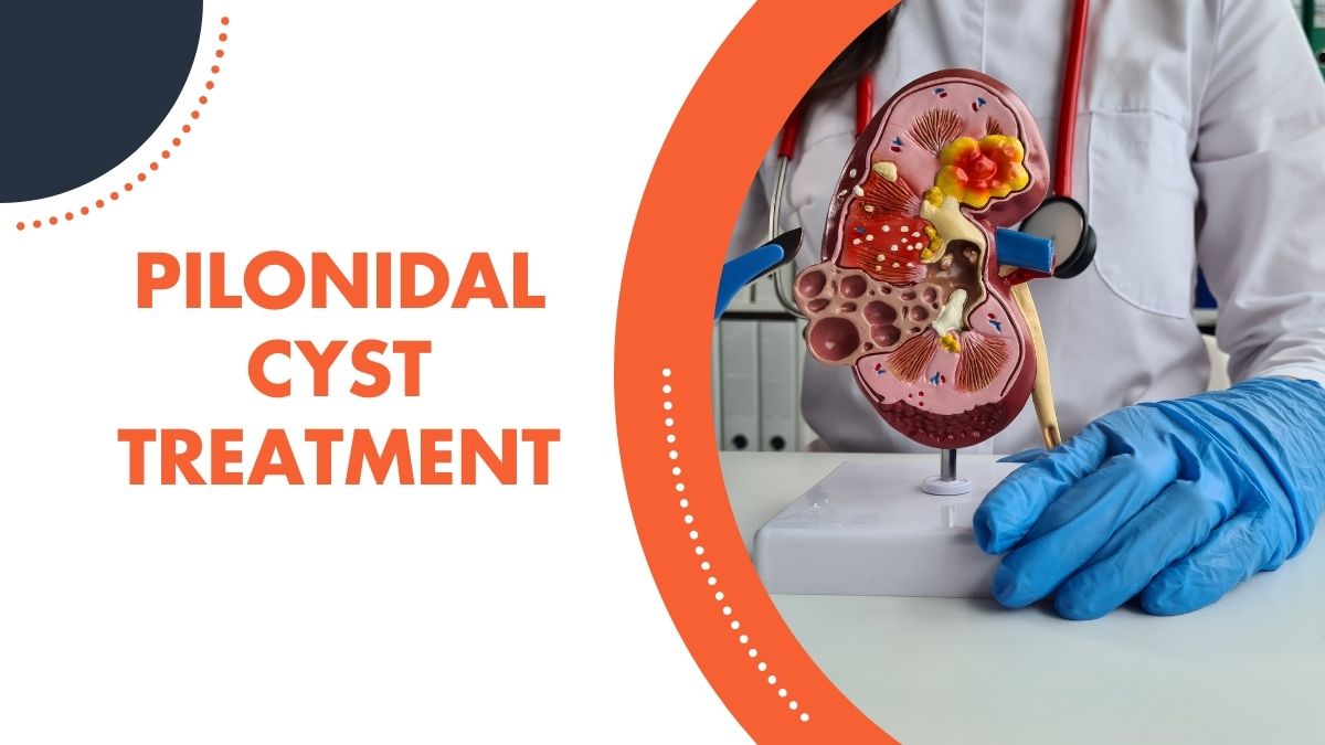 Innovation in Pilonidal Cysts Treatment: What’s on the Horizon?