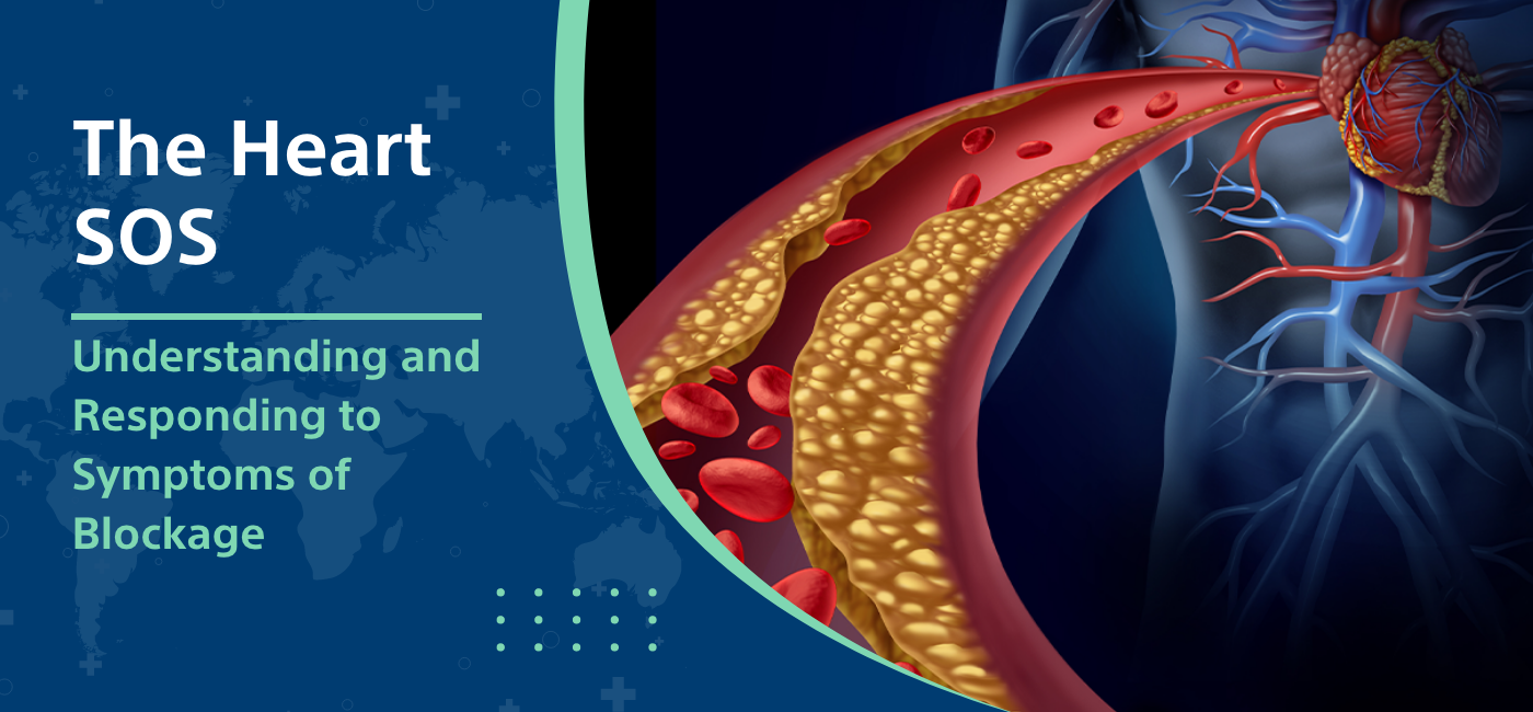 The Heart SOS: Understanding and Responding to Symptoms of Heart Blockage