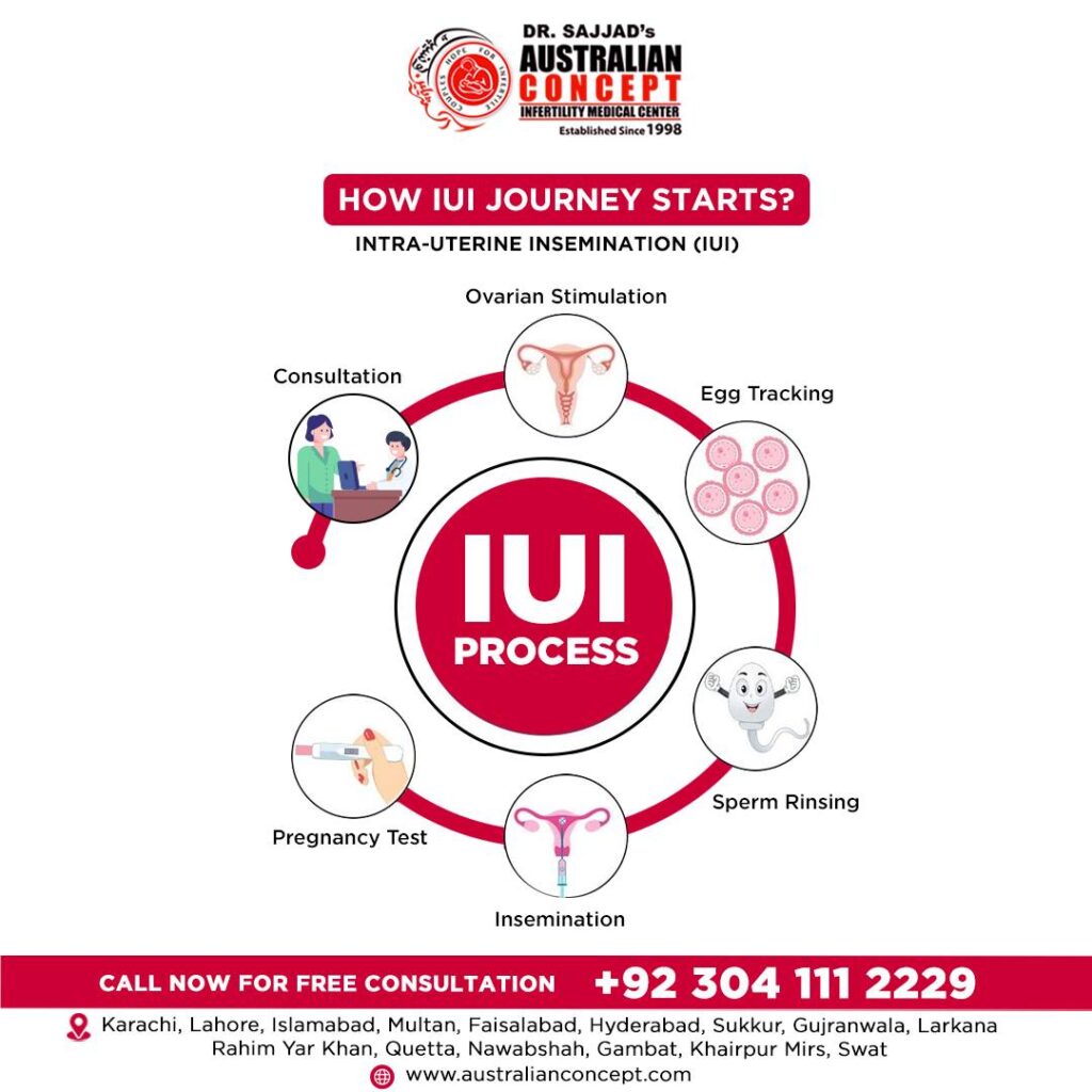 iui treatment