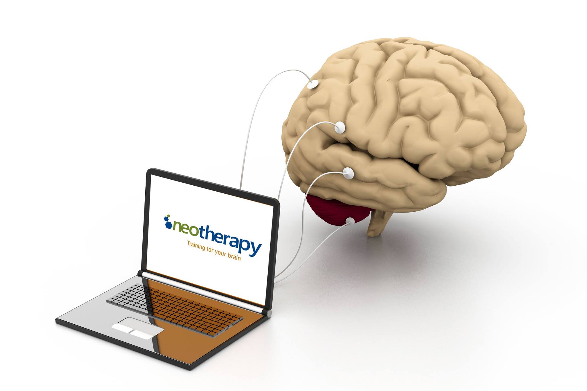 Your Wellness Journey Starts with a Personalized Brain Map